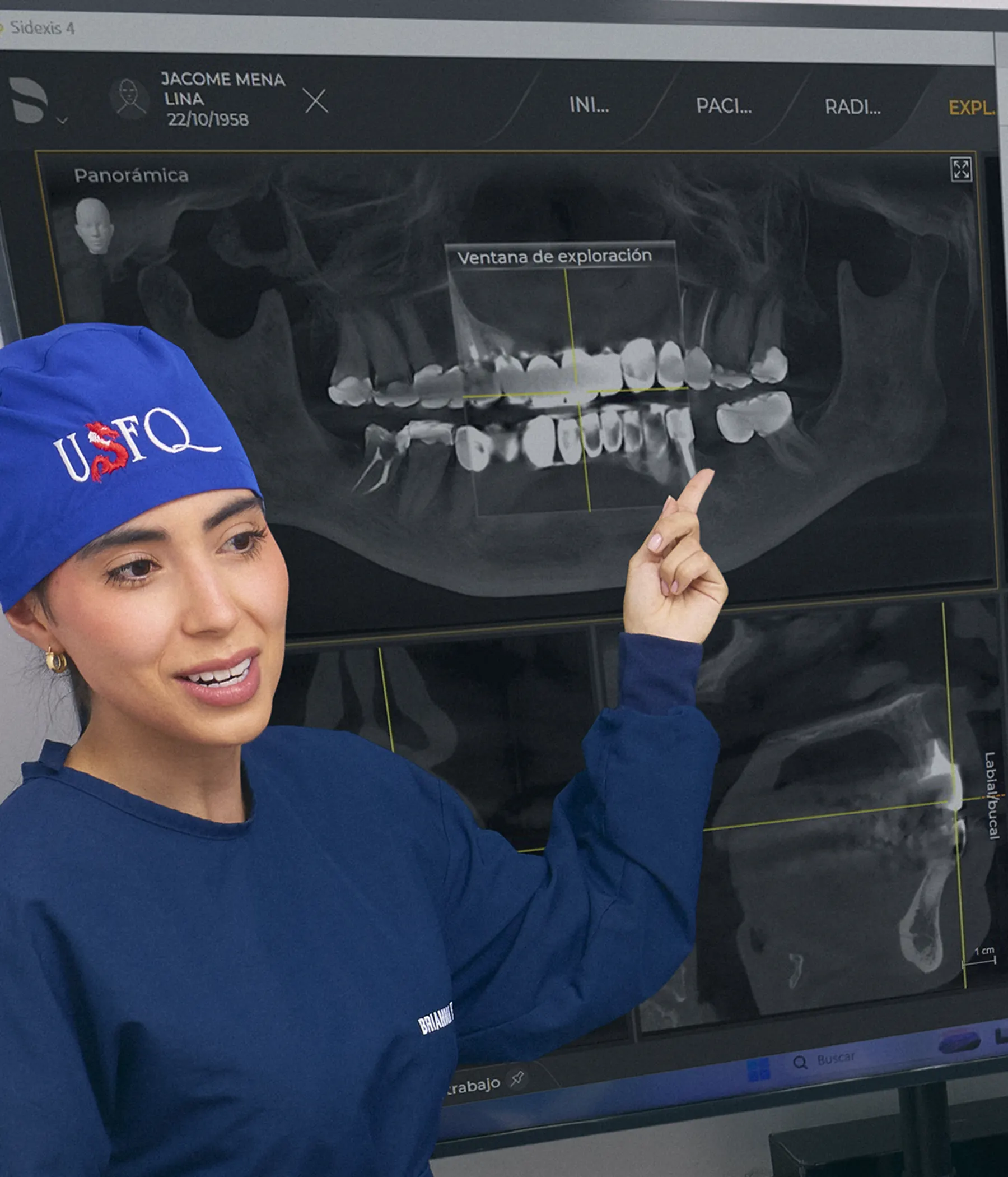 radiografia