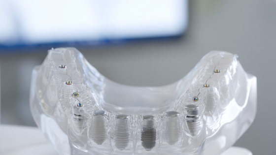 implantologa-clinica4